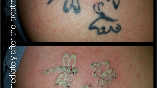 What Involving Statement Do Horrible Tattoos Make?