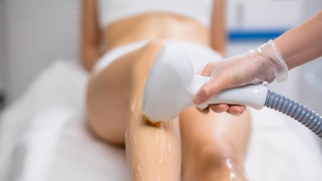Smooth and Silky: Unveiling the Magic of Laser Hair Removal